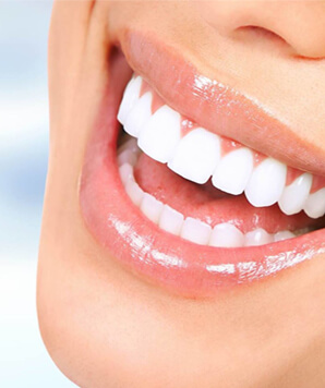 Dental clinic in nagpur - Teeth Whitening